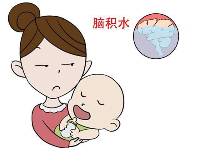 中医治疗脑积水30例疗效观察